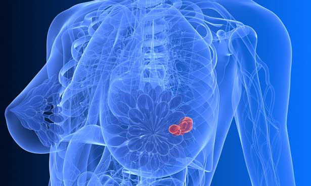 Moleküler Genetik Testler